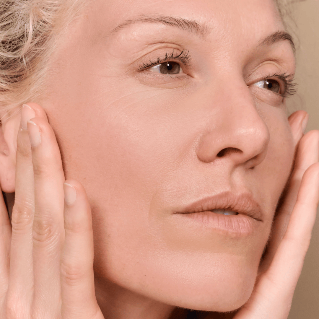 eczema, stress emotion 